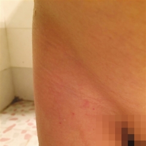 高级托管班数名幼童疑被扎针 涉案老师被刑拘